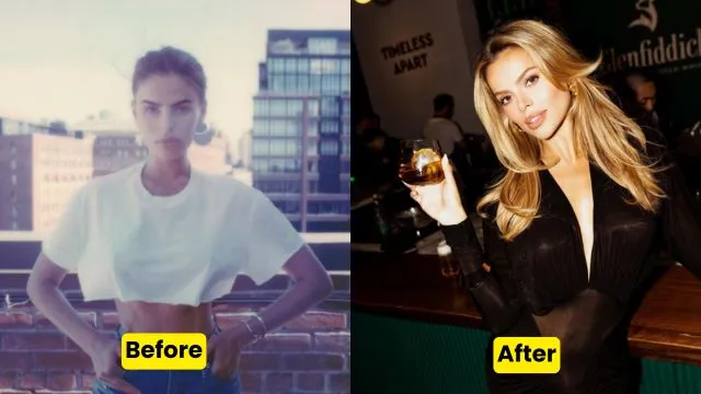 Brooks Nader Before After Plastic Surgery