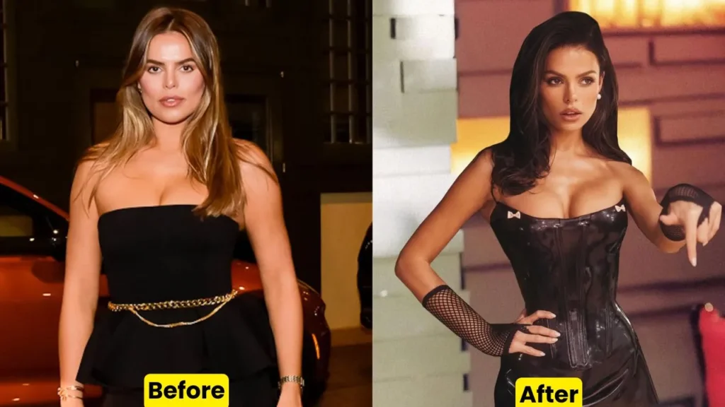 Brooks Nader Weight Loss: Before & After Plastic Surgery. 1 Brooks Nader Weight Loss