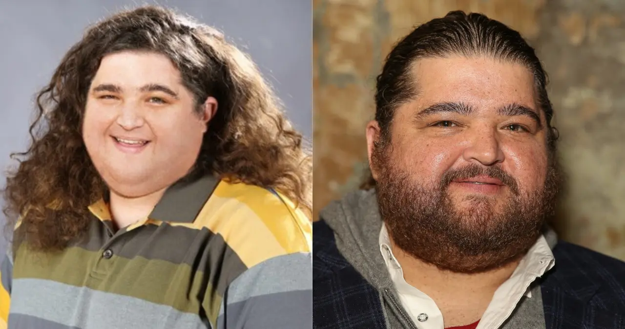 Jorge Garcia Weight Loss Journey. Diet Or Surgery? 1 Jorge Garcia Weight Loss Journey