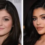 Secret Of Kylie Jenner and the Evolution of Her Beauty. 11 Kylie Jenner Before Afte