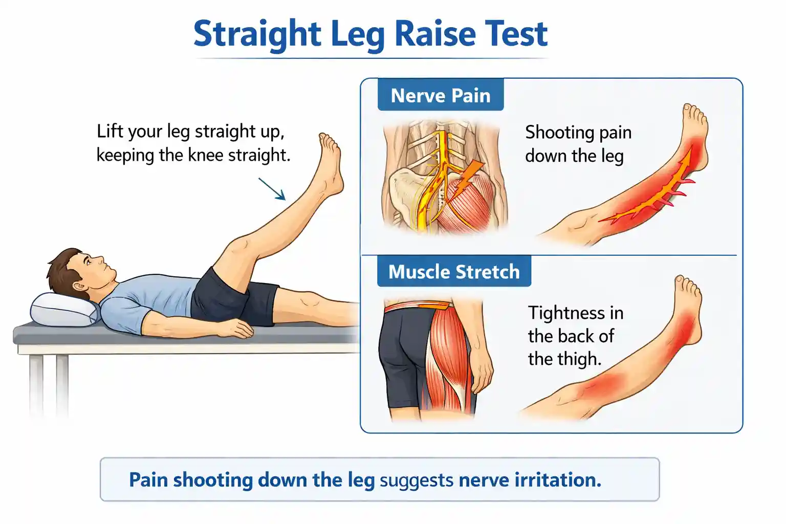 straight leg raise test