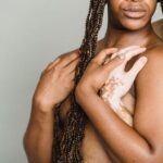 can psoriasis cause hair loss