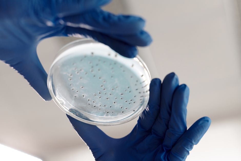 how the indirect immunofluorescence assay works