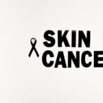 radiotherapy cause hair loss