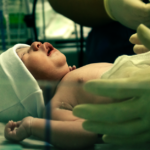 what causes and treats neonatal hyperbilirubinemia