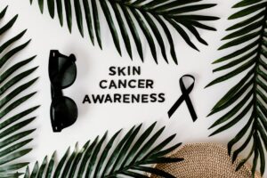what causes moles on skin