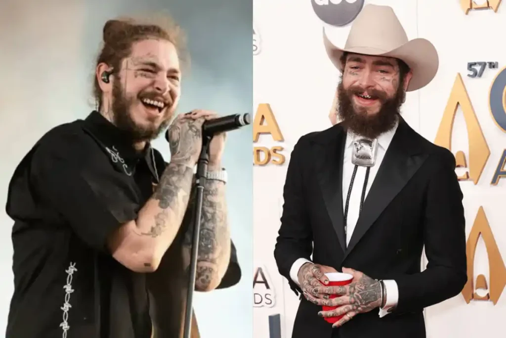 Post Malone Weight Loss