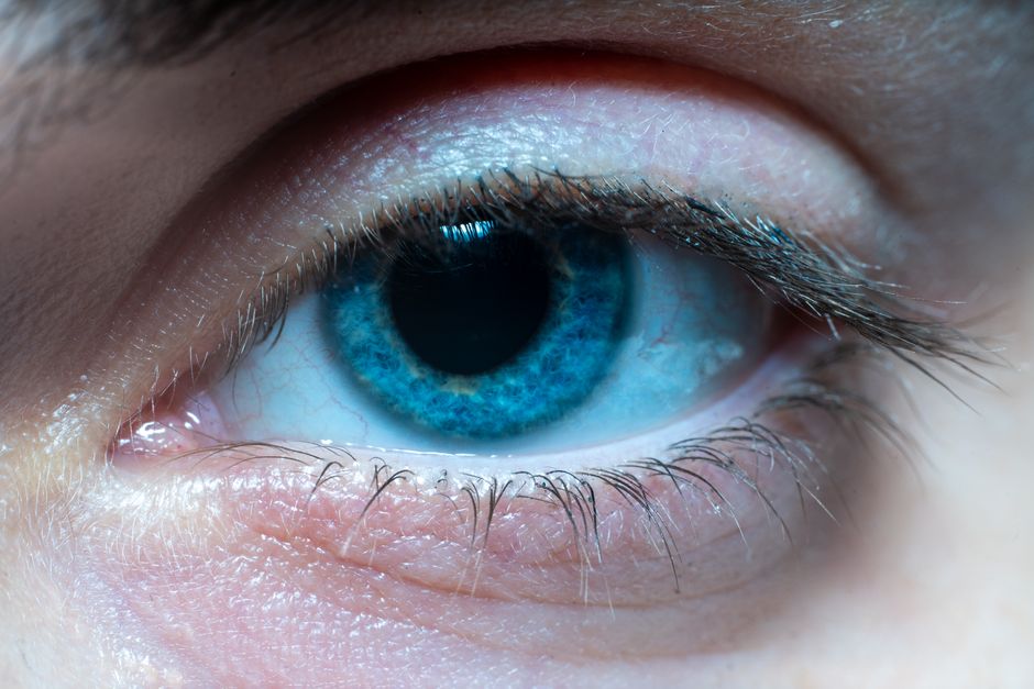 are blue eyes more sensitive to light
