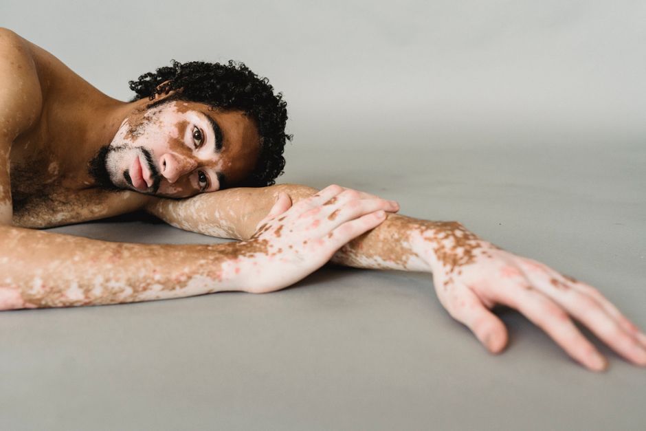 do indians have melanin the science of indian skin