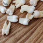 do you lose your molars