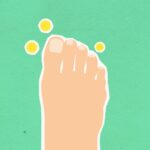 how do you get a fungal infection and whos at risk