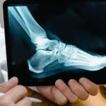 how long does bone infection take to heal