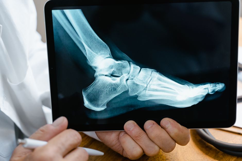 how long does bone infection take to heal