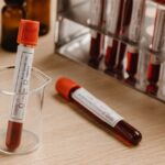 how serological tests detect immunity and infection