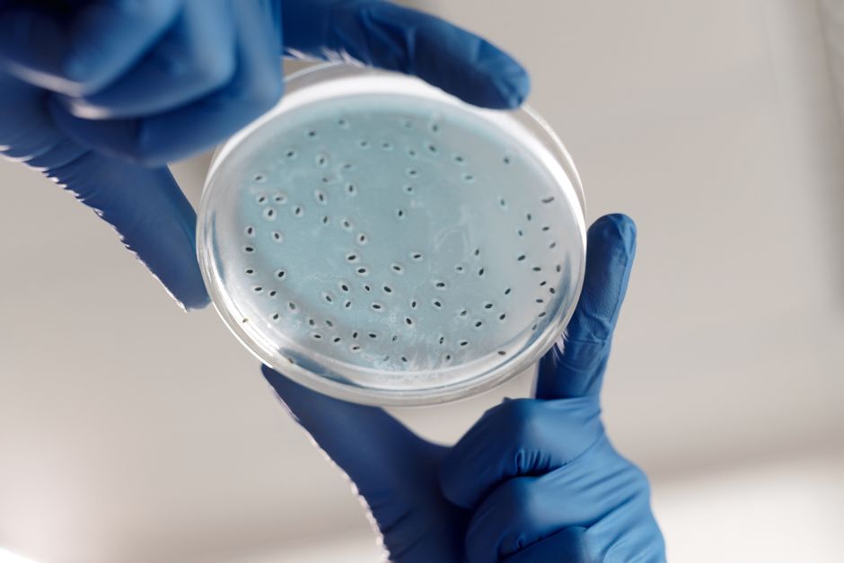 how to calculate bacterial growth