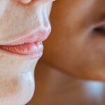 how to get dry skin off lips 3 methods that work
