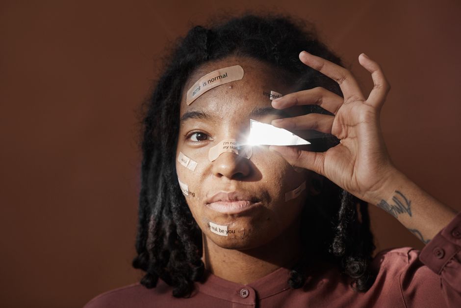 how to heal a popped pimple fast without scarring