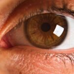 how to heal a scratched cornea
