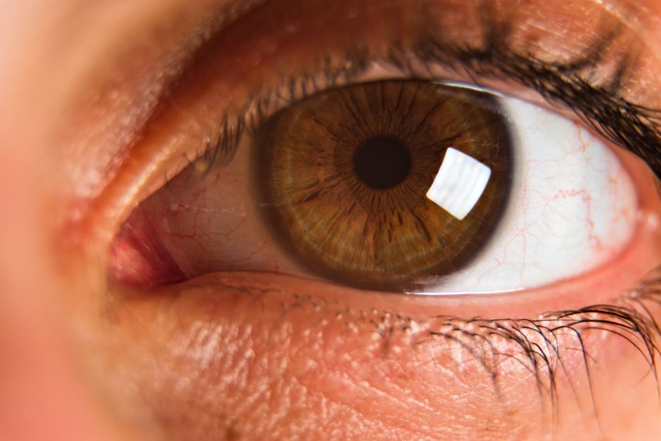 how to increase vision naturally