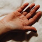 how to see your blaschko lines and what they mean