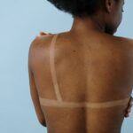 how to treat a rash behind your ear at home