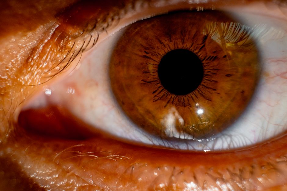 is color blindness genetic