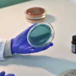 is dupuytrens contracture genetic or hereditary
