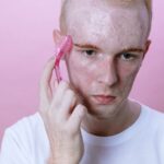 what causes hormonal acne in men