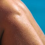what causes itchy bumps on skin and how to get relief
