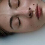 what causes red moles on skin and when to worry