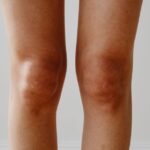 what causes sudden knee pain without injury