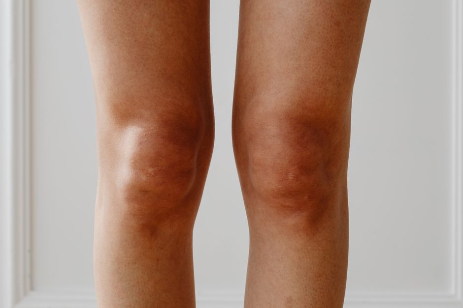 what causes sudden knee pain without injury