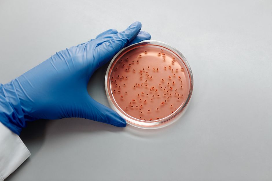 what does salmonella look like