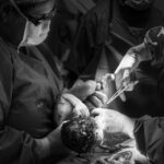 what is a cesarean section