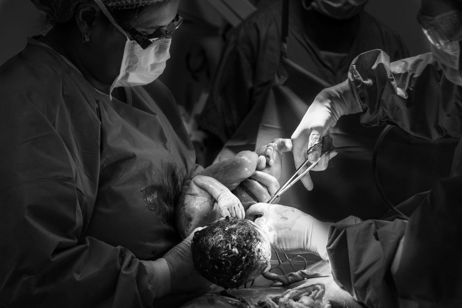 what is a cesarean section