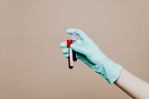 what is a colonoscopy test procedure prep risks