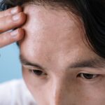 what is a skin tag causes symptoms and removal