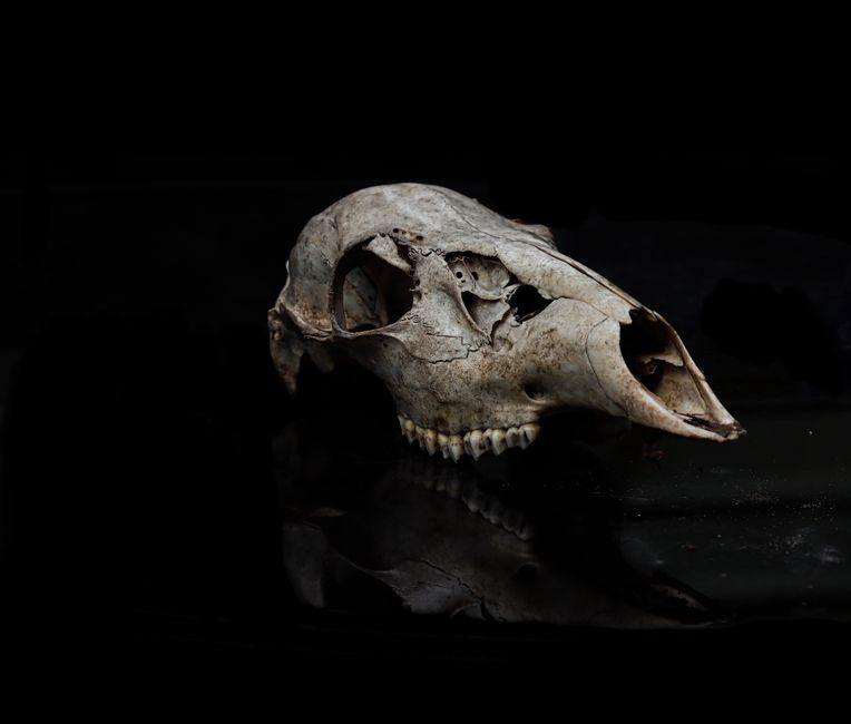 what is avn bone death from lack of blood flow