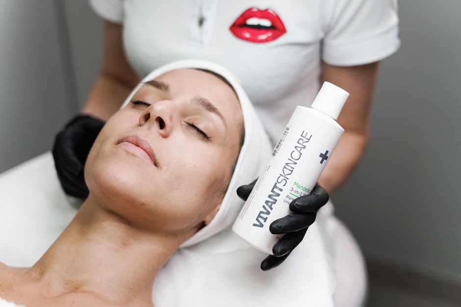 what products work best for rosacea prone skin
