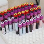 when to use sample vs population standard deviation