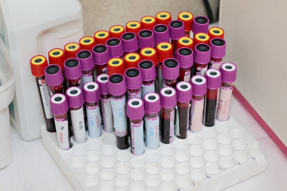 when to use sample vs population standard deviation