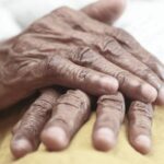 why is my knuckle swollen causes and what to do