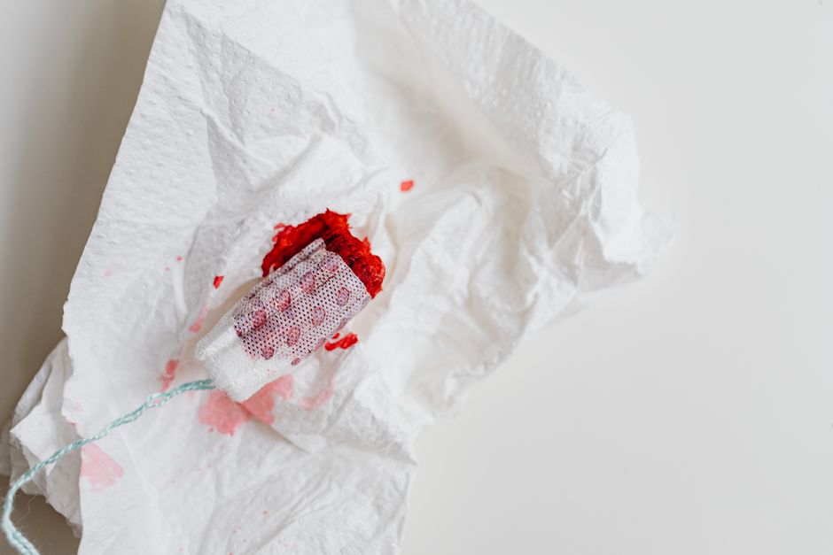 can polyps cause bleeding