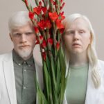 can white people be albino