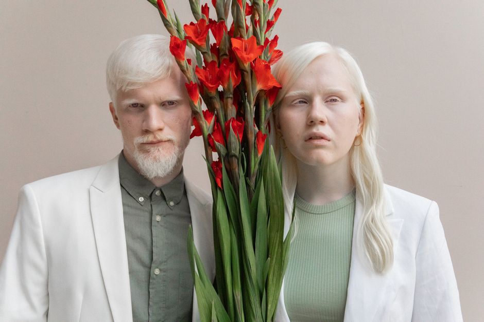 can white people be albino