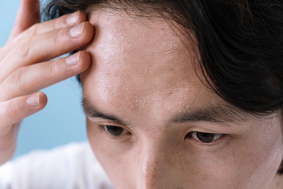 does sweating help with sickness