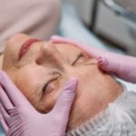 does tretinoin help with wrinkles