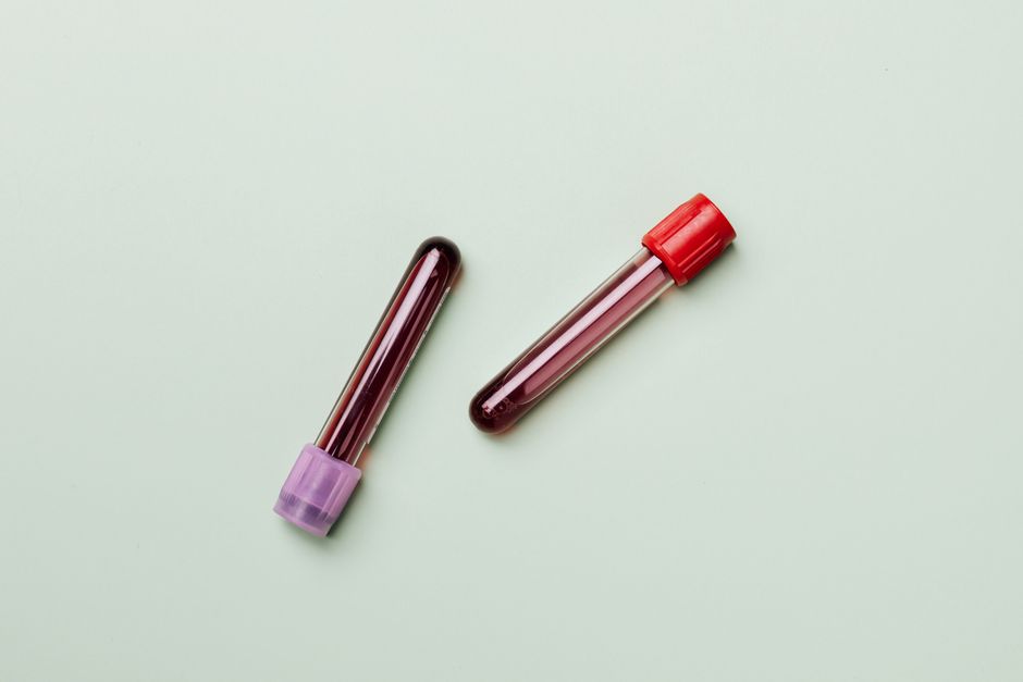how at home std tests work from sample to results