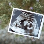 how big is a fetus at 12 weeks