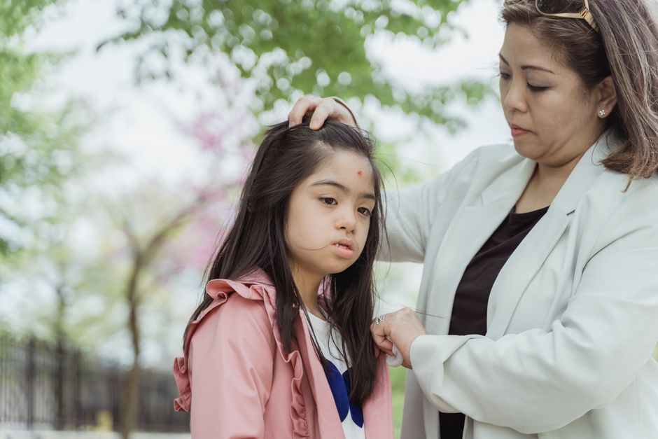 how can i tell if i have lice signs and symptoms
